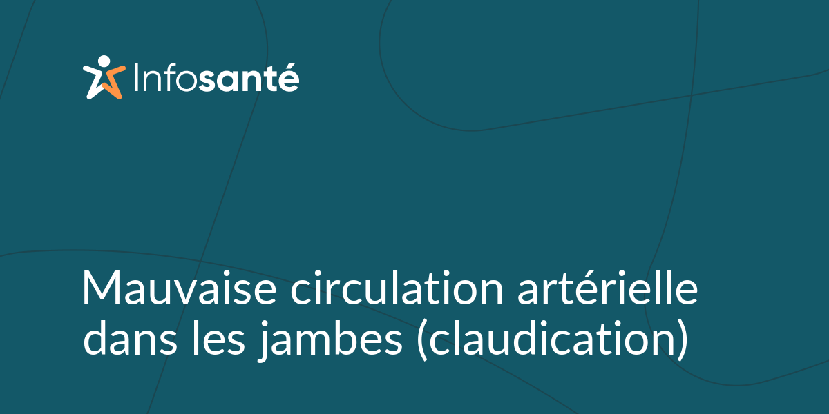 Mauvaise circulation artérielle dans les jambes (claudication) • Infosanté — free download