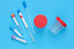 Dépistage des Infections Sexuellement Transmissibles (IST)